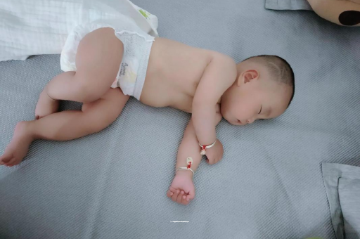 镇江六个月宝宝眼睛散光